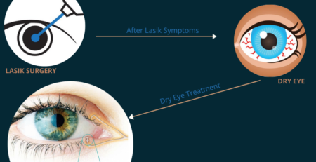 Dry Eye Treatment With Lense Home Products